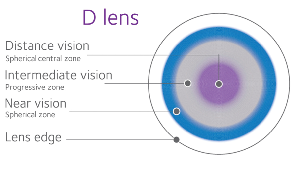 Schematic of the Biofinity “D” multifocal contact lens. 