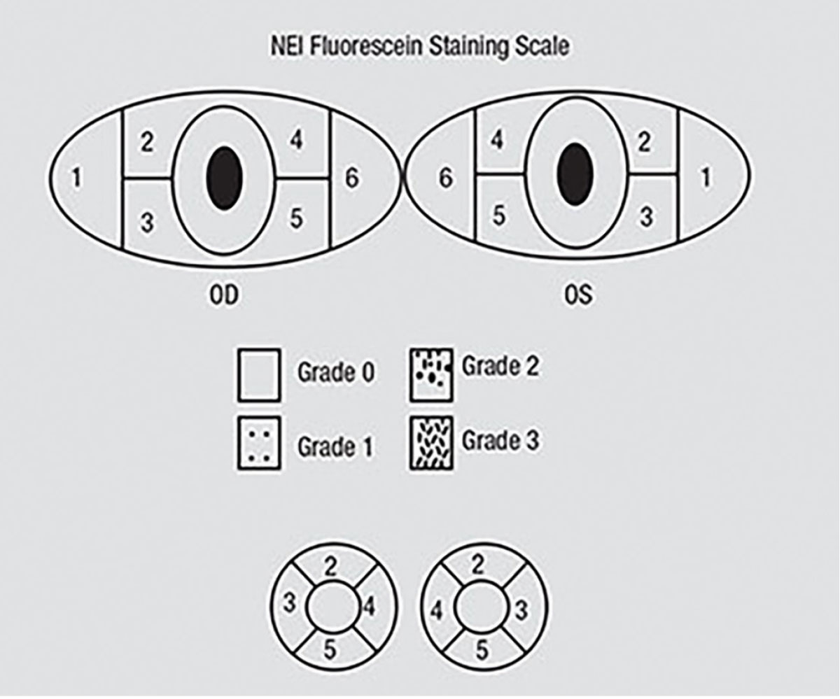 The NEI scale for grading fluorescein staining divides the corneal and conjunctival surfaces to help measure fluorescein uptake. A standardized grading system of 0 to 3 is used for each of the five areas on each cornea. Grade 0 is specified when no staining is present.