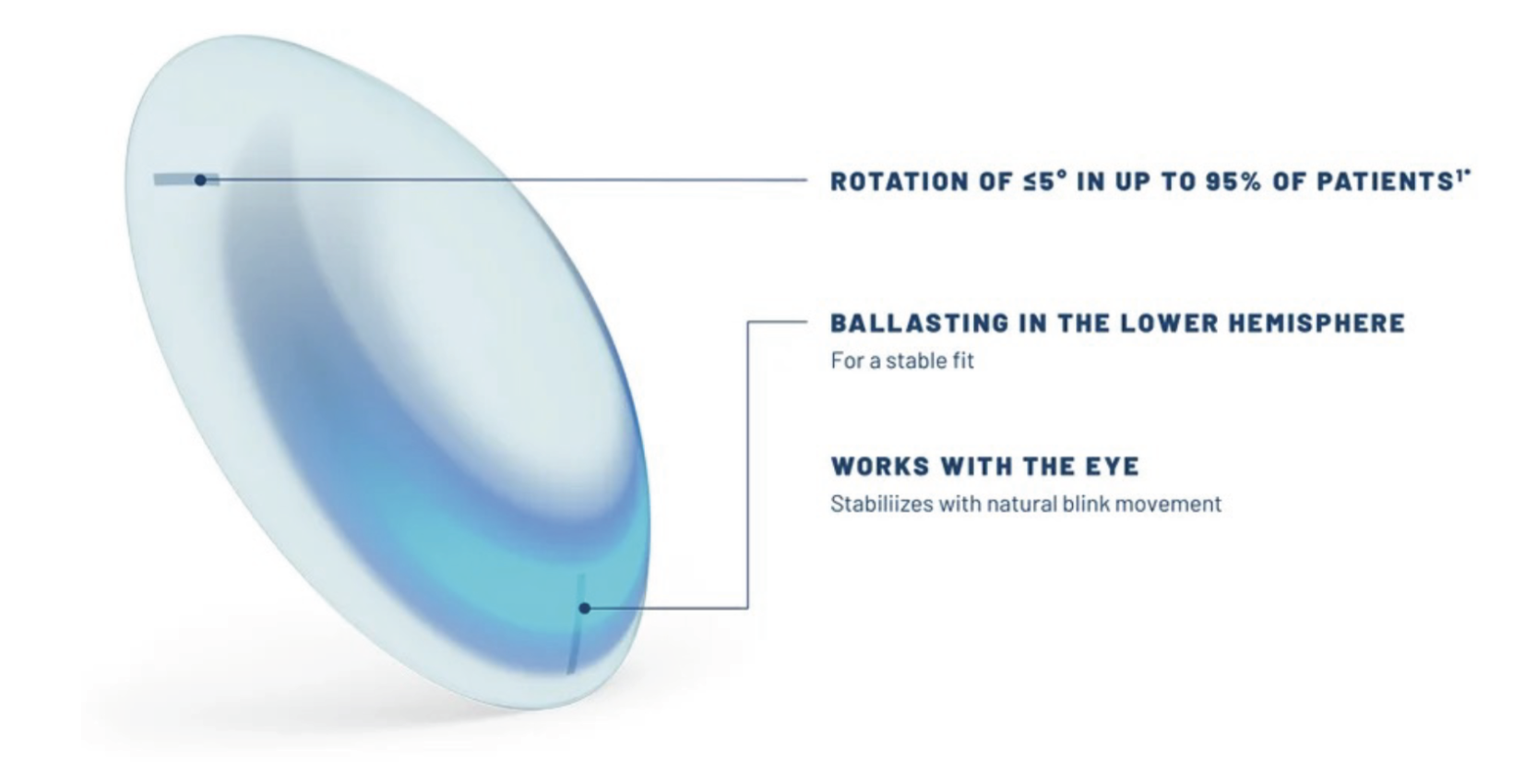Fig. 3. B+L’s “OpticAlign” design, featured in Ultra multifocal for astigmatism, guarentees a rotation of 5° or less for 95% of patients.