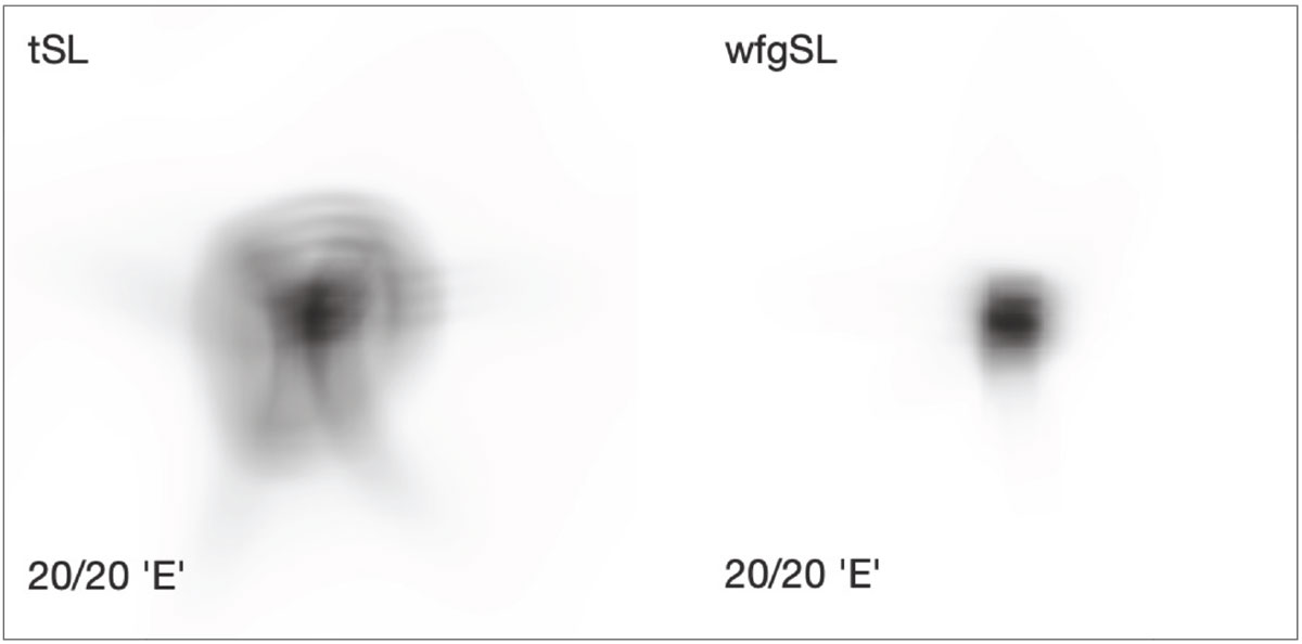 Fig. 4. Comparison of how the same patient would see an ‘E’ on the 20/20 line on a traditional Snellen eye chart. The patient gained one line of visual acuity wearing the wfgSL compared to the tSL. This is simulated using wavefront aberrometry data using a 7.8mm pupil diameter.